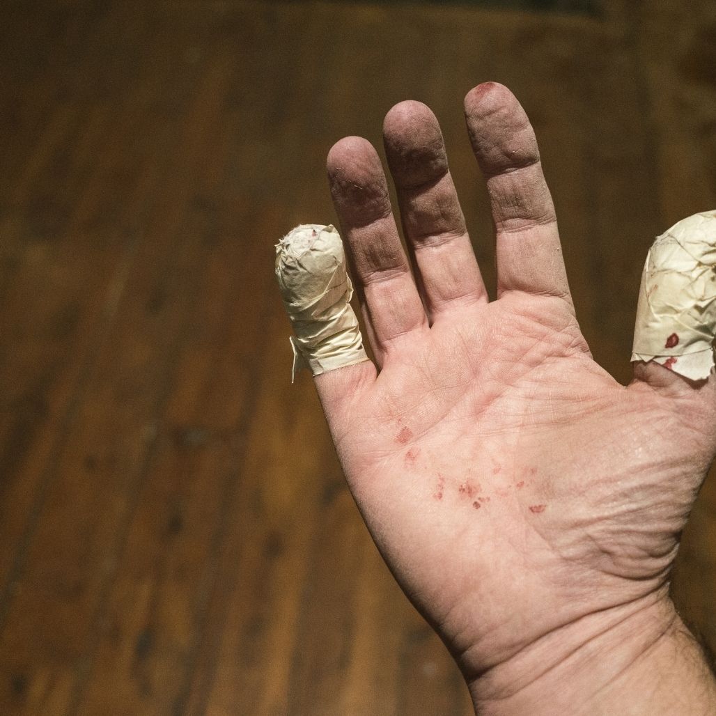 3 Most Common Types of Hand Injuries Harmony Lab and Safety